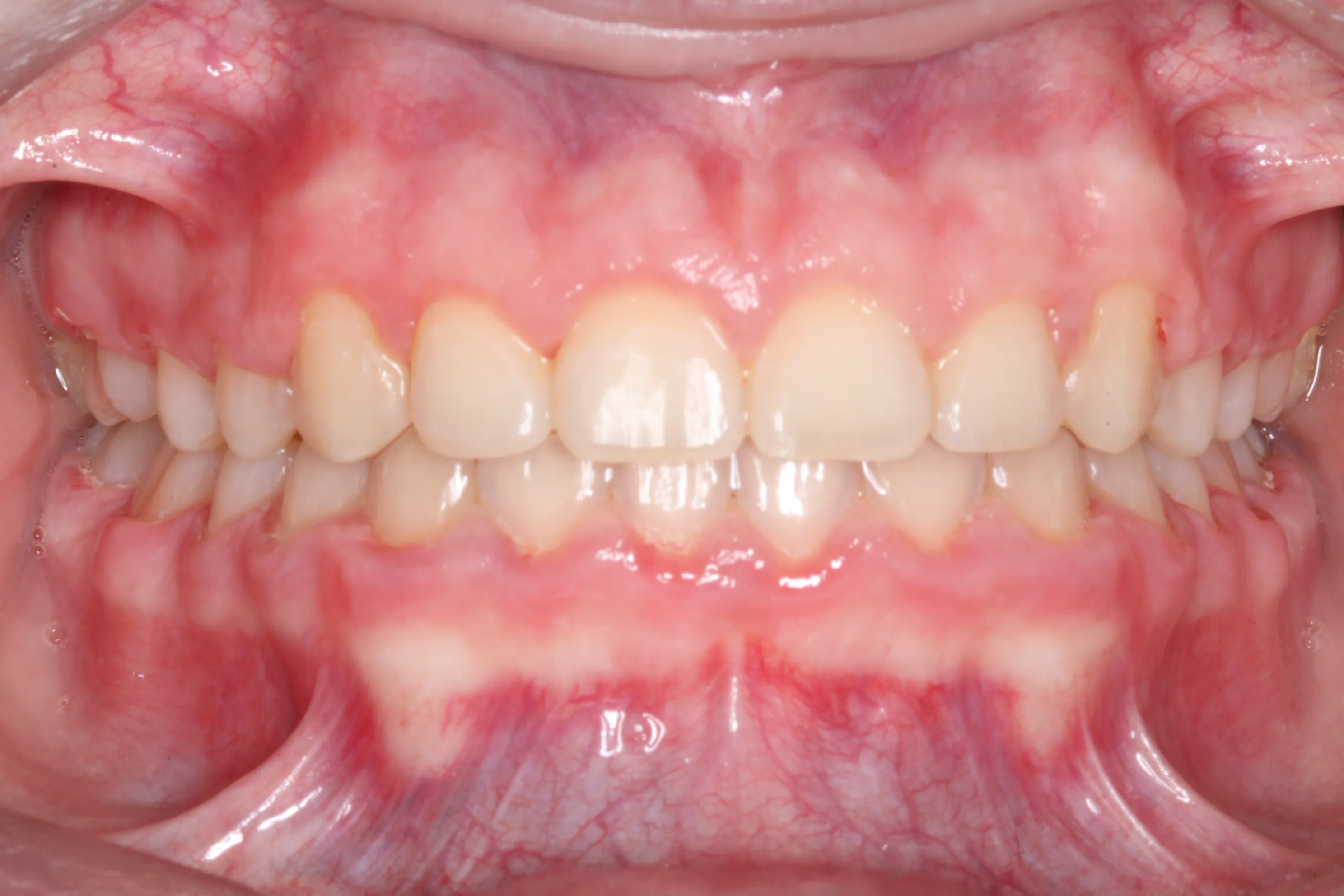 smile-gallery gallery